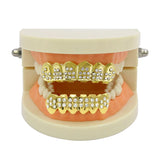 Lianfudai Gold Plated Iced Out CZ Teeth Grillz For Unisex Bling Full Zircon Pave Top&Bottom Grills Set Punk Hip Hop Dental Jewelry